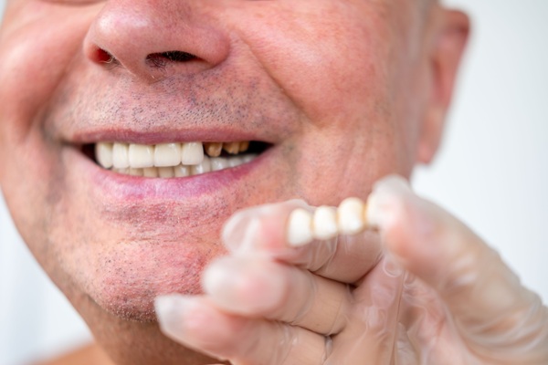 Ask A Restorative Dentist: Why Do I Need A Crown After A Root Canal?