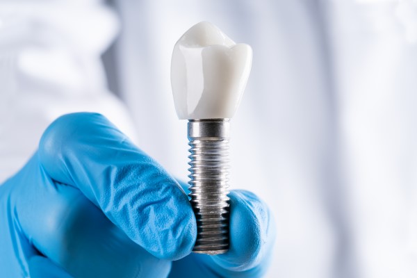 How To Take Care Of Dental Implants 