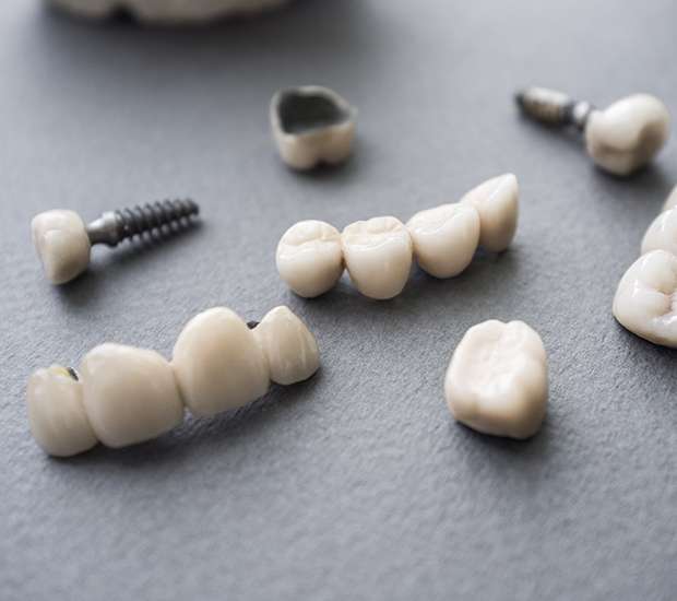 Pasadena The Difference Between Dental Implants and Mini Dental Implants