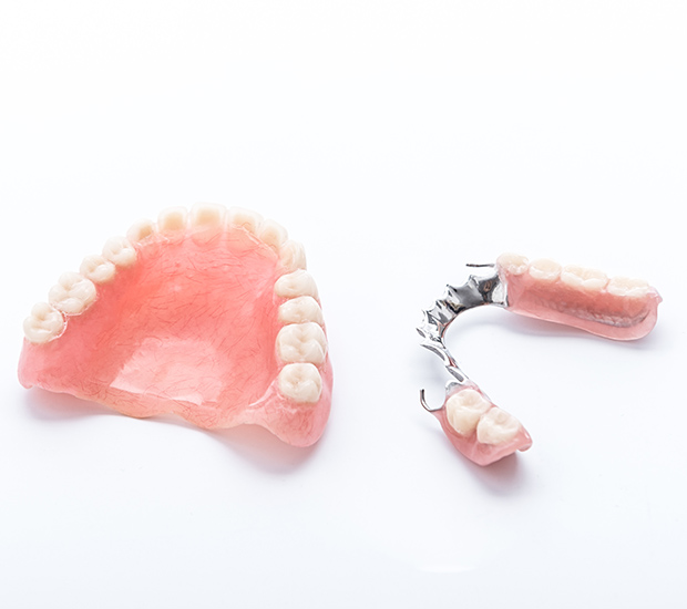 Pasadena Partial Dentures for Back Teeth